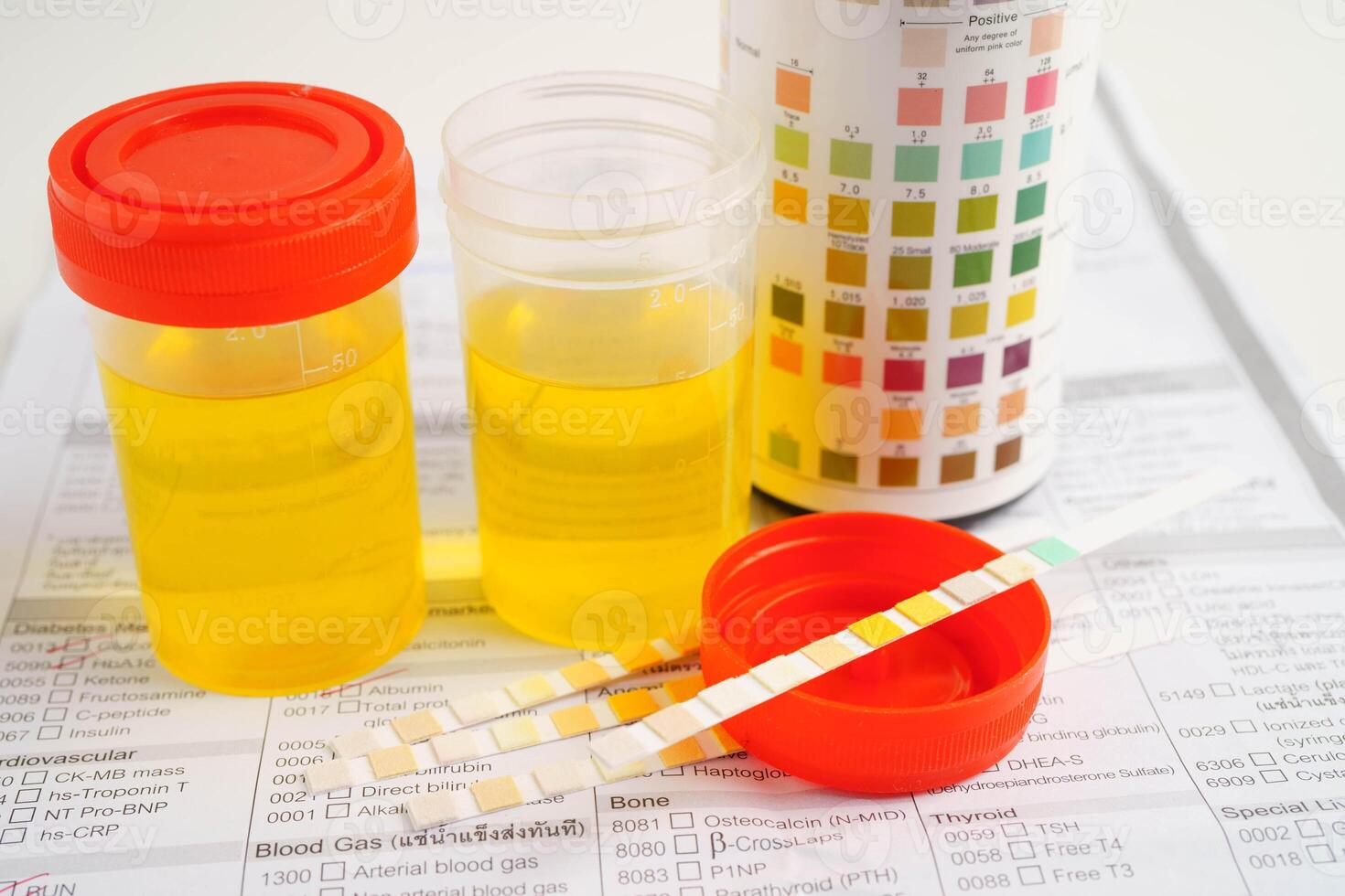 Urinalysis, urine cup for check health examination in laboratory. photo