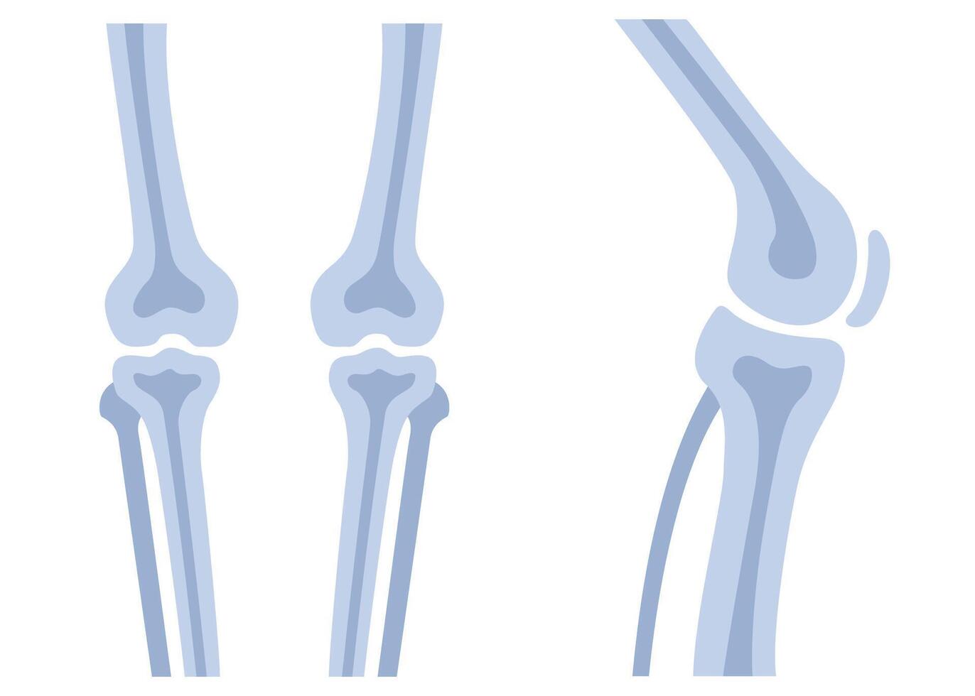 Human knees bones and joints, examination and diagnosis. Healthcare and rheumatism analysis, physical care in hospital or clinics vector