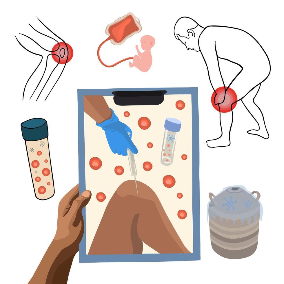 Stem cell treatment. Stem cells in a test tube. Stem cells are injected into the knee. vector