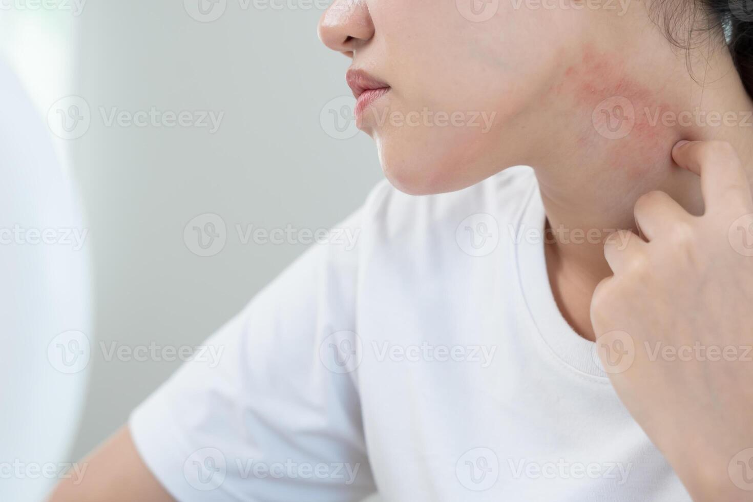 Skin problems Women have itchy skin and red rashes from cosmetic allergies, steroid allergies, sensitive skin, redness from sunlight, chemical allergies, rashes, insect bites. photo