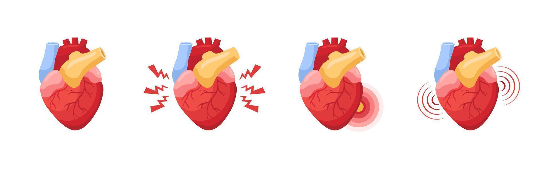 Heart animation showing different stages of pain from mild discomfort to severe vibrations vector