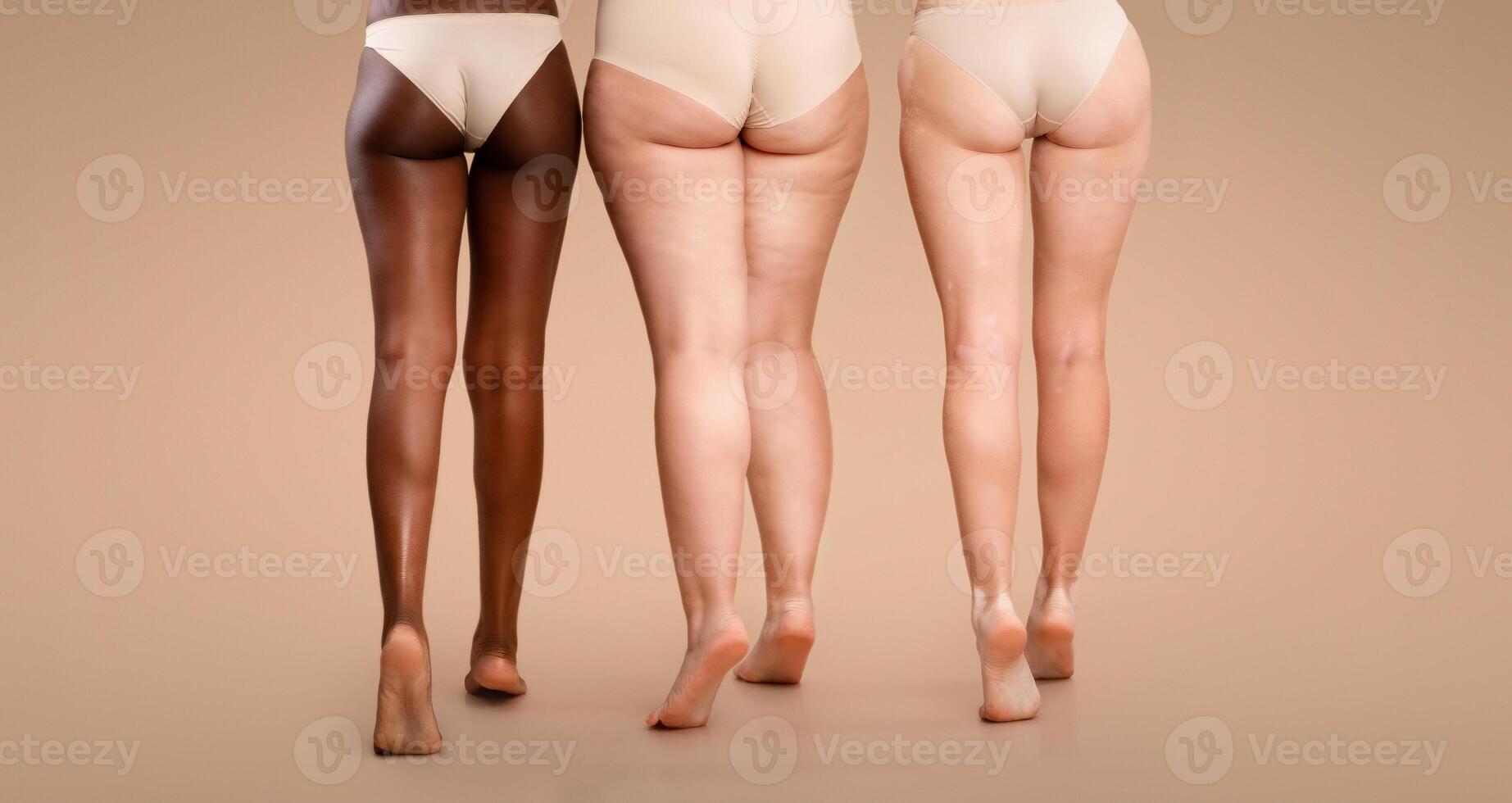 Rear View Of Three Women With Different Body Types In Underwear, Legs Of Multi-Ethnic Ladies With Diverse Skin Conditions Standing In Lingerie On Beige Studio Background, Cropped Image With Free Space photo