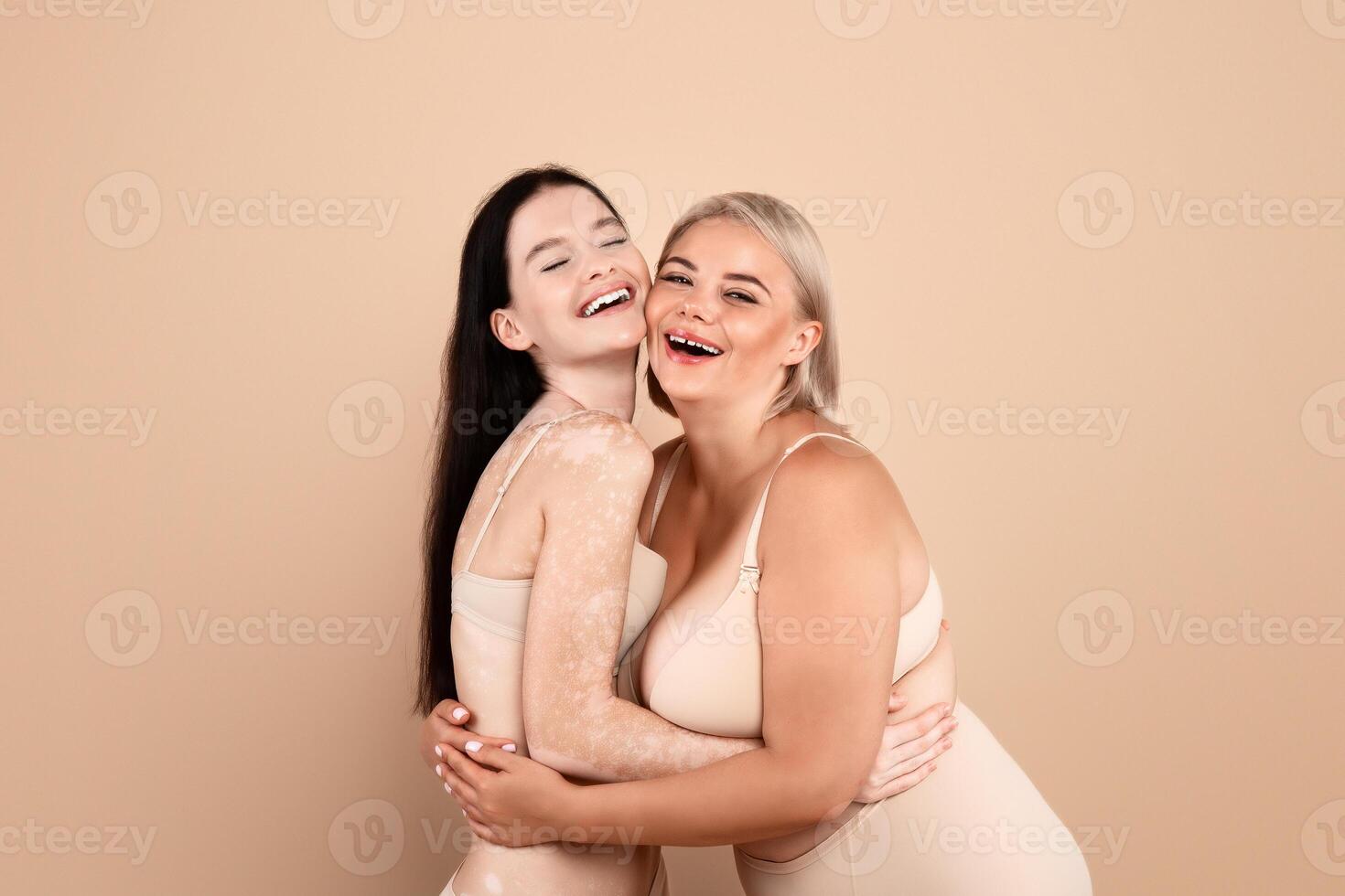 Portrait Of Two Happy Body Positive Women In Underwear Embracing And Laughing Together, Plus Size Lady And Female With Vitiligo Skin Disorder Posing Over Beige Studio Background, Copy Space photo