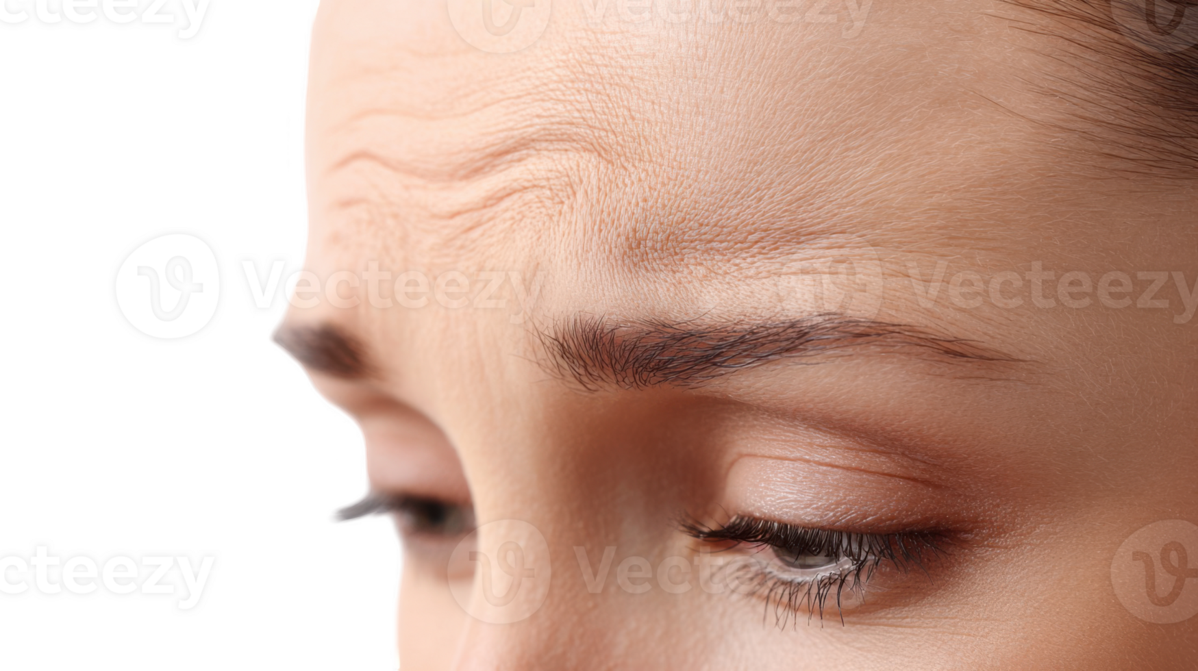 Woman showing dry skin and wrinkles on forehead with transparent background png