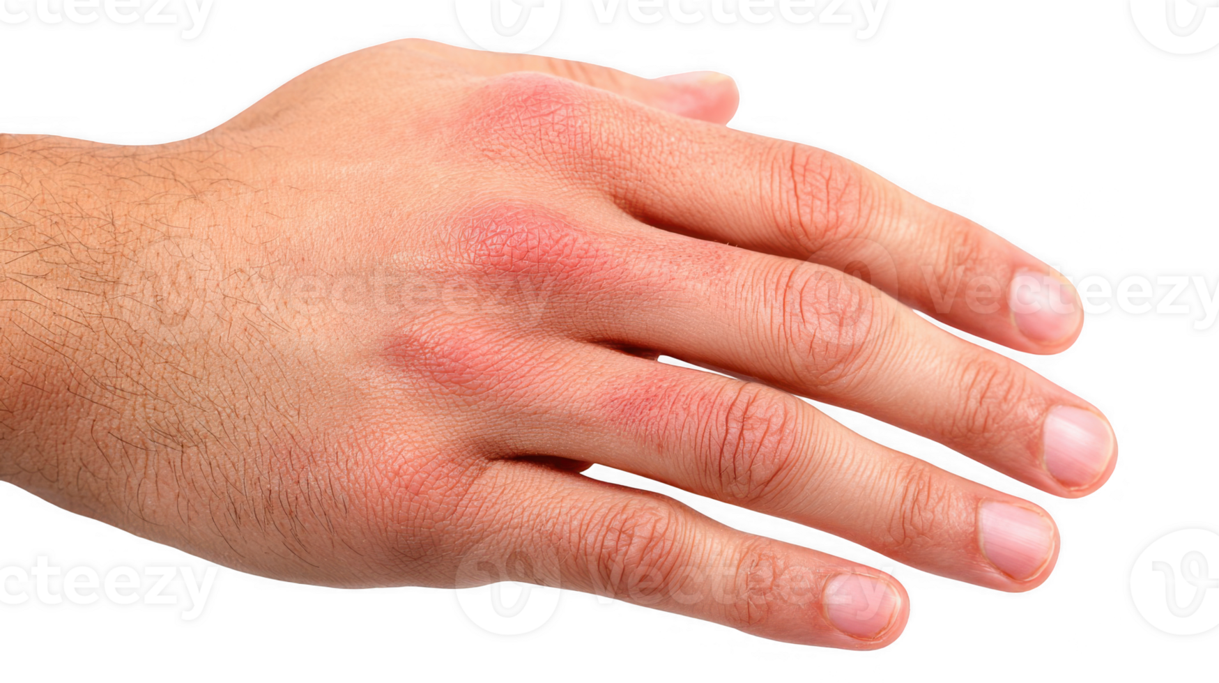 Man showing red rash on hand on transparent background png