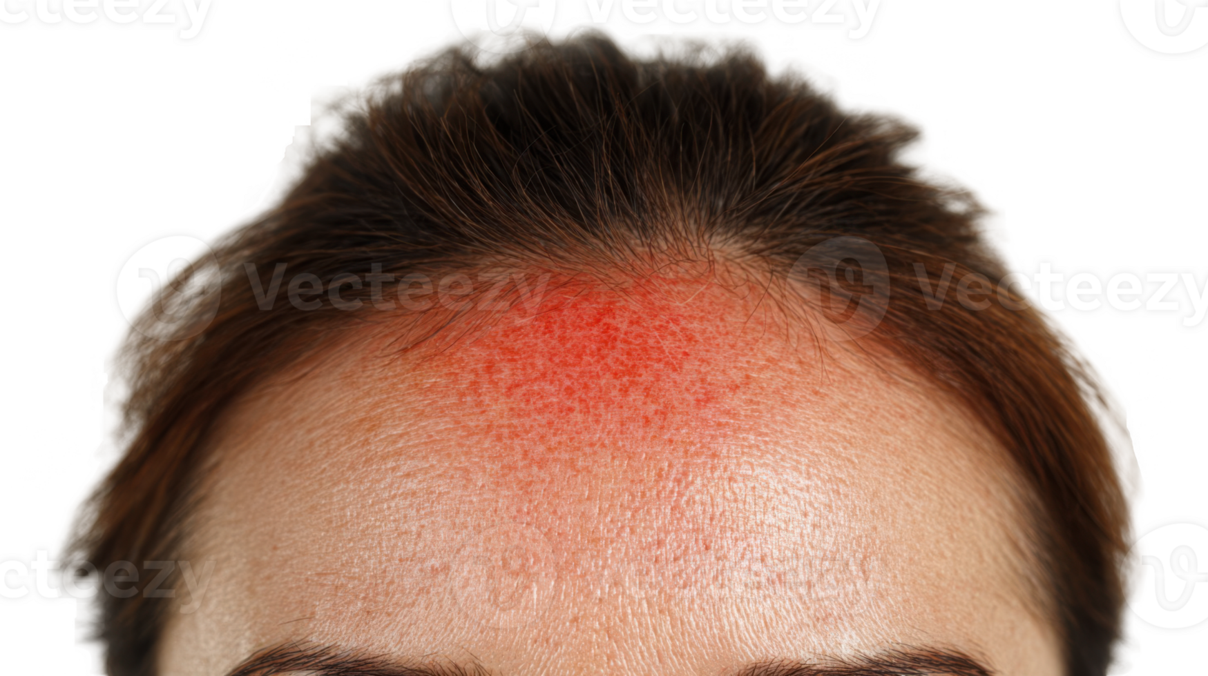Woman showing red forehead spot on transparent background png