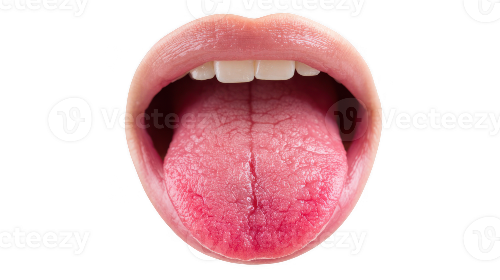 Open mouth showing inflamed tongue with glossitis on transparent background png