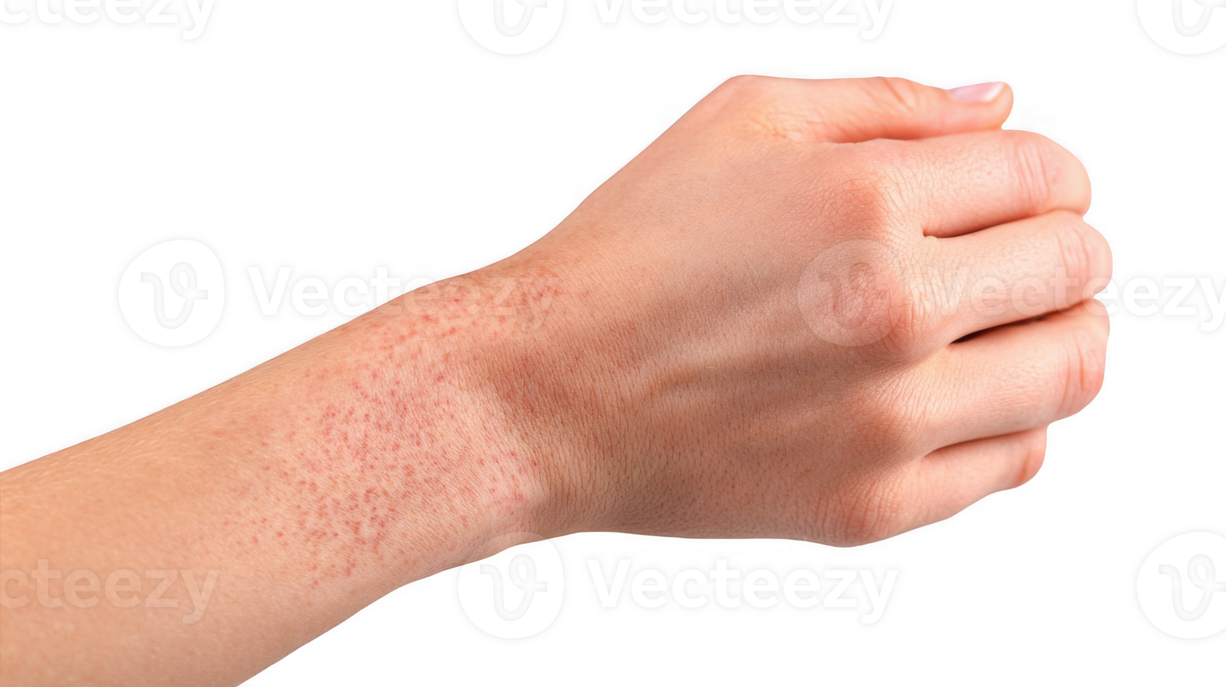 Woman showing red rash on wrist on transparent background png