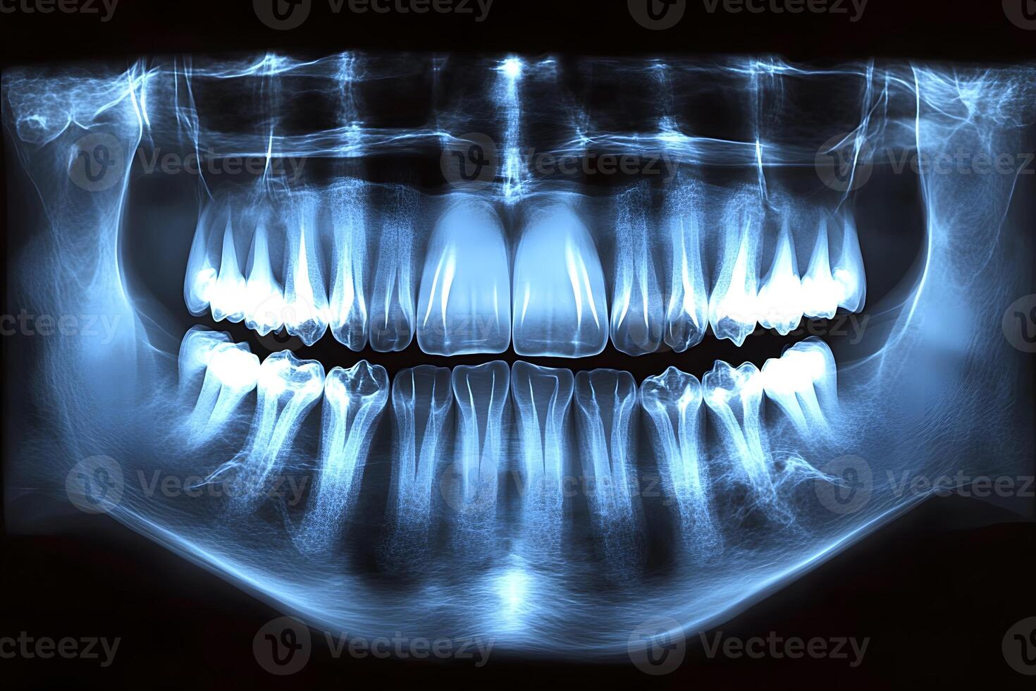 Dental X-Ray Imaging for Oral Health Diagnosis and Treatment Planning photo