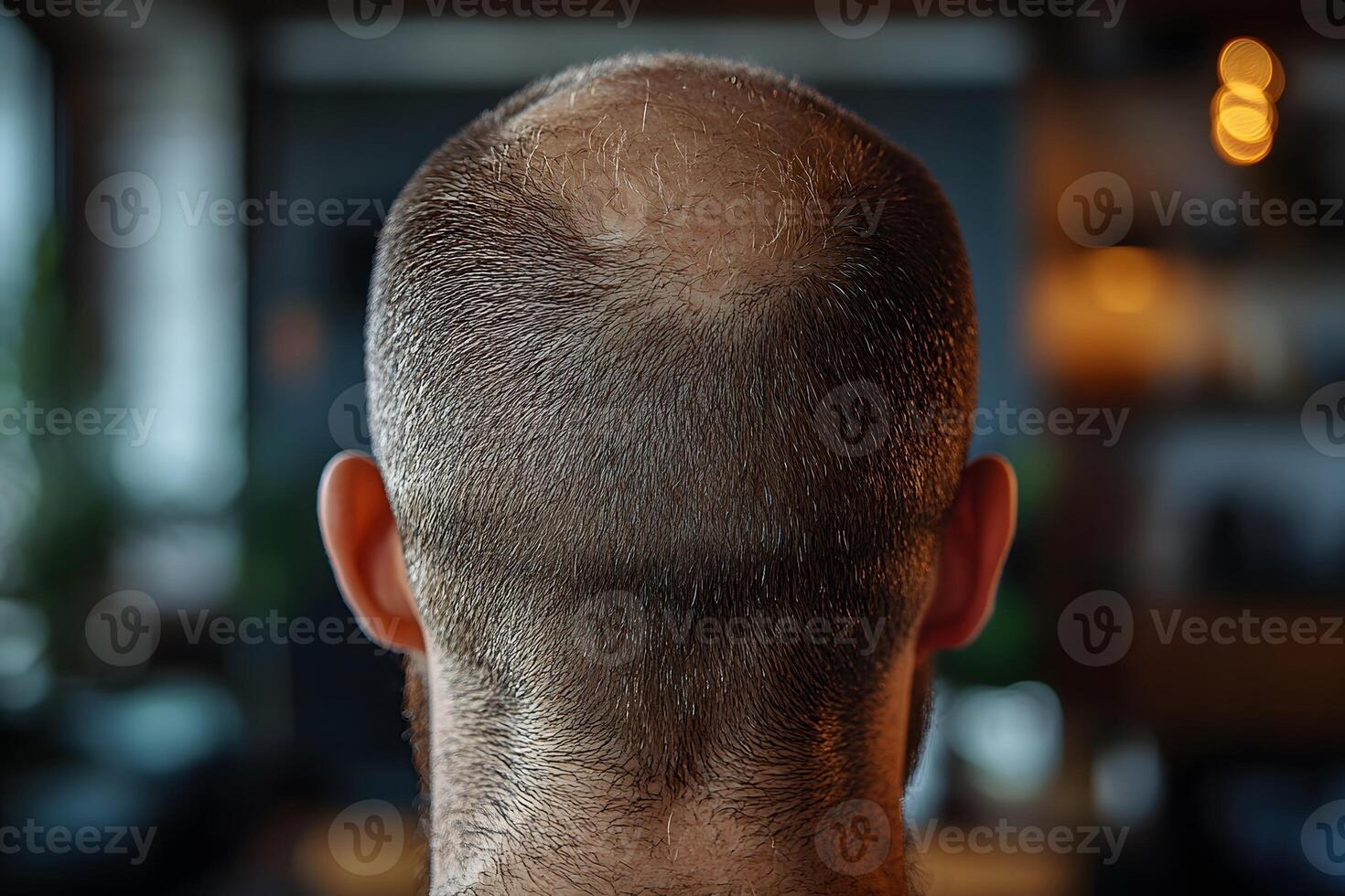 Baldness and Hair Loss Concept Close-up of Male Bald Spot in Indoor Setting photo