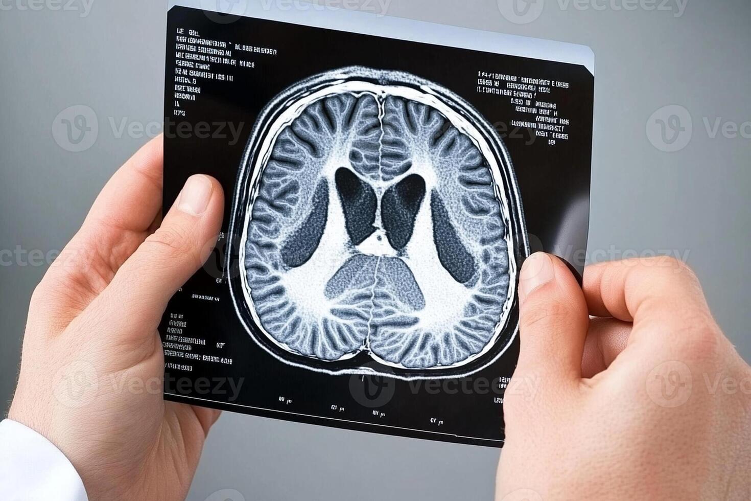 A person holding up a mri scan photo