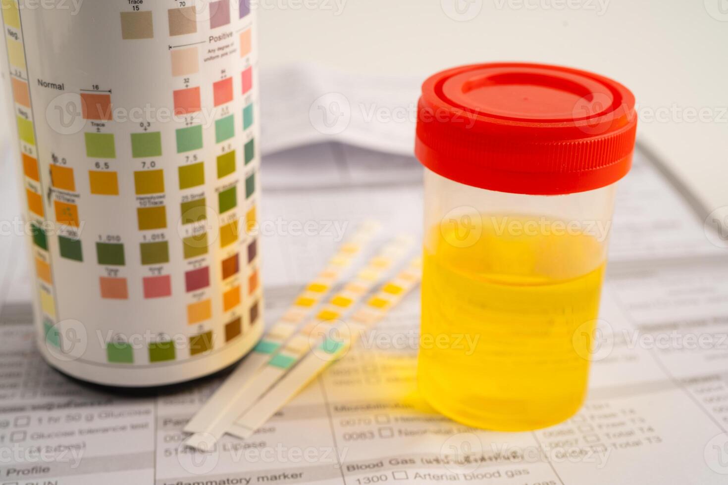 urine cup with reagent strip pH paper test and comparison chart in laboratory. photo