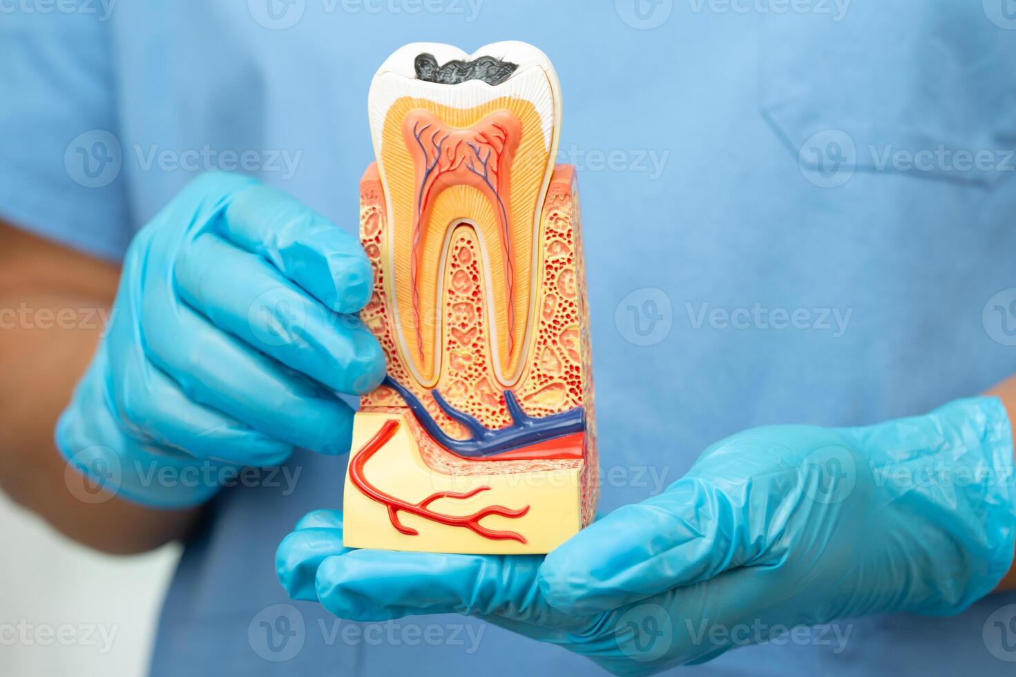 dentist holding dental implant, artificial tooth roots into jaw, root canal of dental treatment, gum disease photo