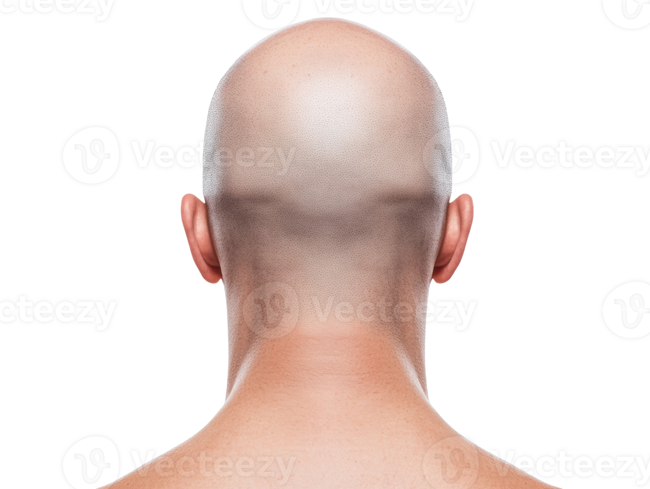 Bald head close-up showing skin texture and scalp health png
