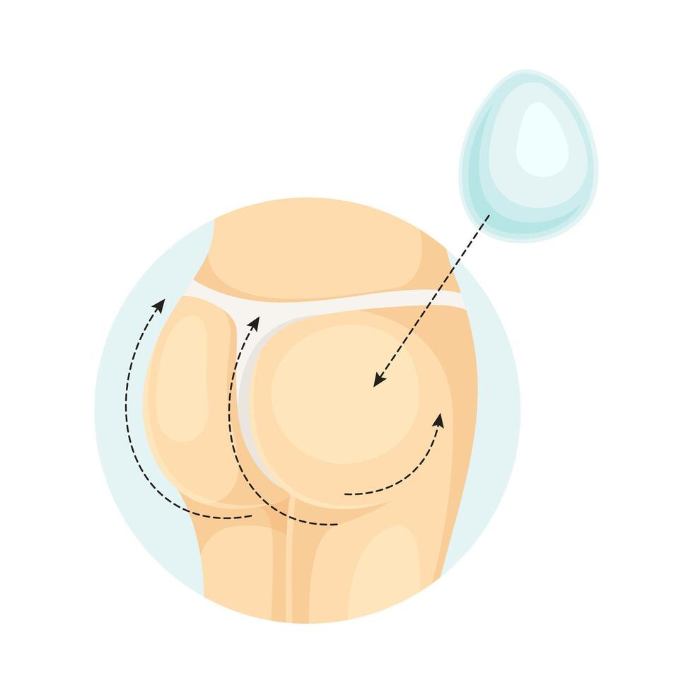 Female buttocks after correction of implants. Plastic surgery illustration vector
