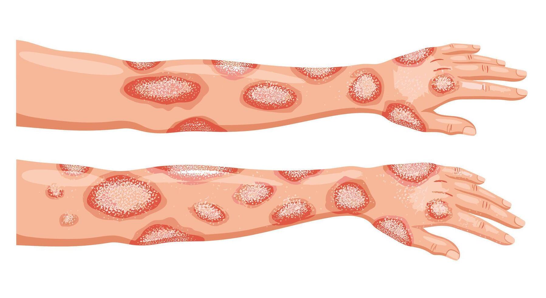 Understanding Skin Rash Conditions Symptoms Causes Diagnosis and Treatment Options A Complete Guide vector
