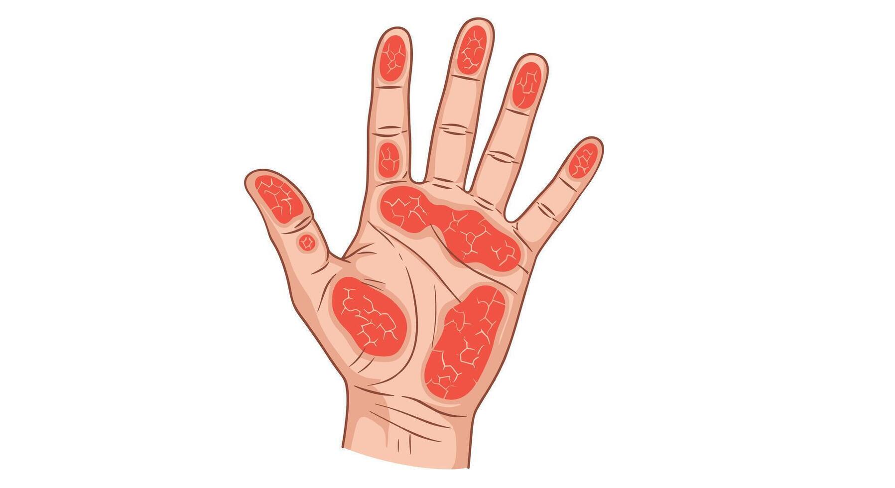 The Hand Body Map A Guide to Healing Through Hand Reflexology Techniques vector