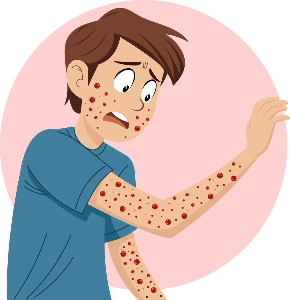Illustration of a young man. He looks stressed and has several irritated red spots scattered all over his body on his arms. vector