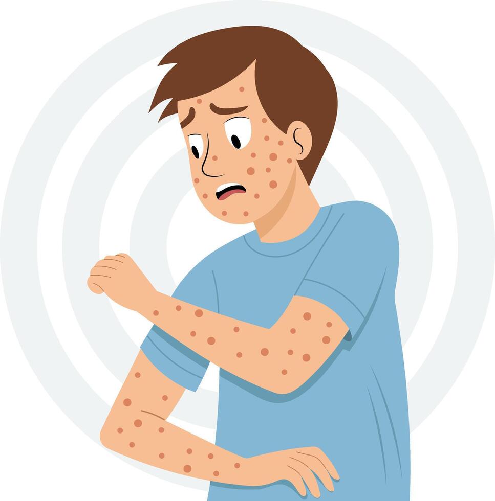 Illustration of common skin conditions in men or viral skin infections. vector