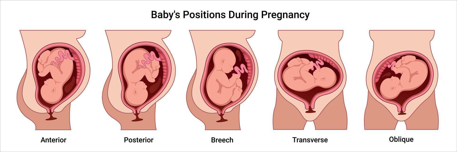 Baby positions in pregnancy vector
