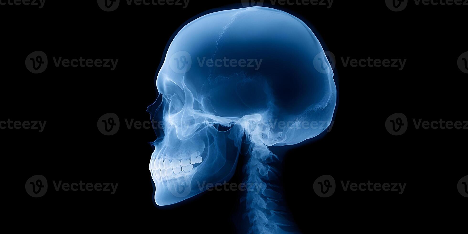 Human Skull XRay Side View Anatomy Image photo