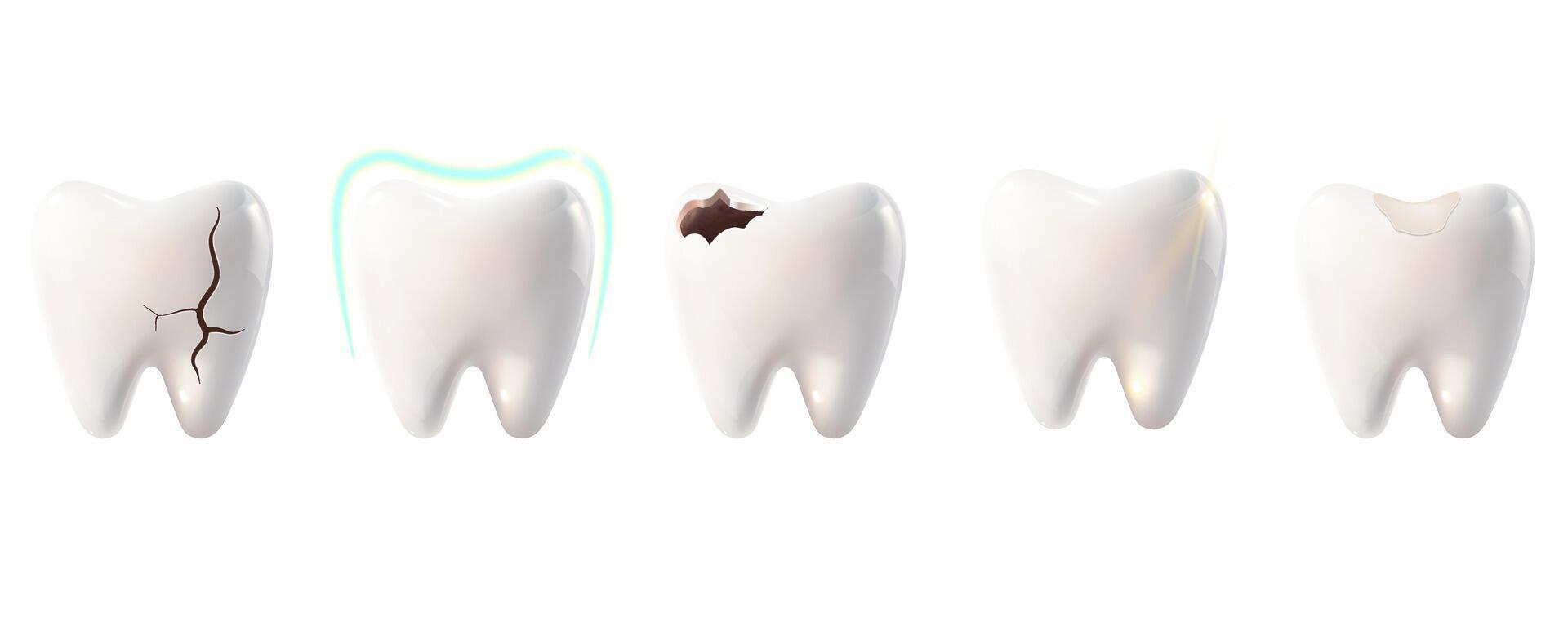 A set of healthy and damaged teeth. A tooth with a crack, filling, caries, and protection. Dentistry, dental care, orthodontics, oral health concept. 3D illustration on a white background. vector