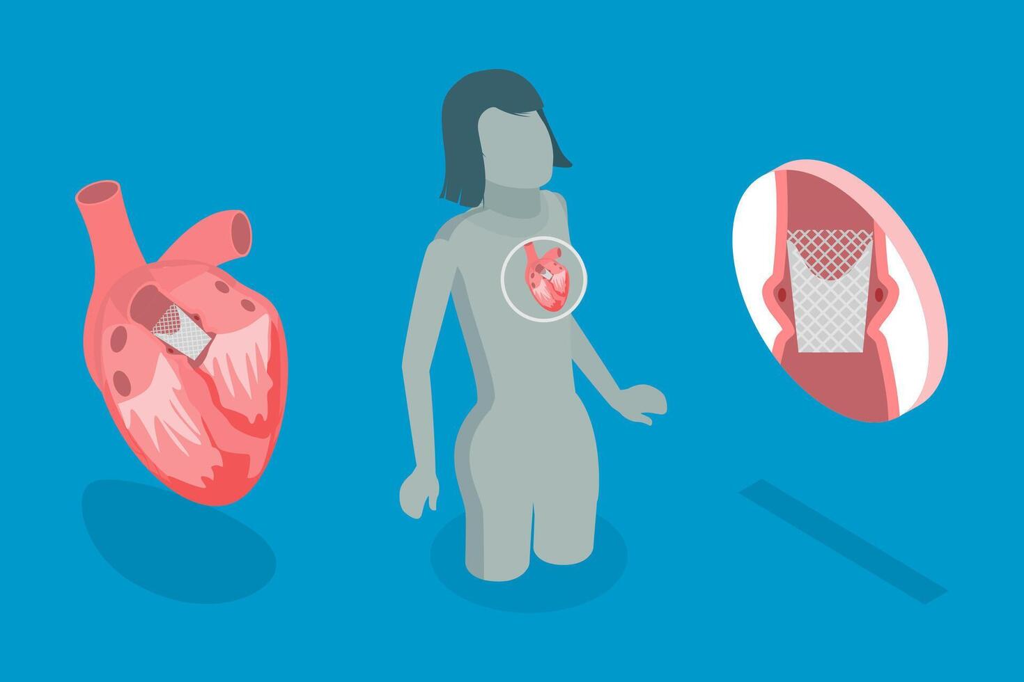 Illustration of heart treatment technology vector