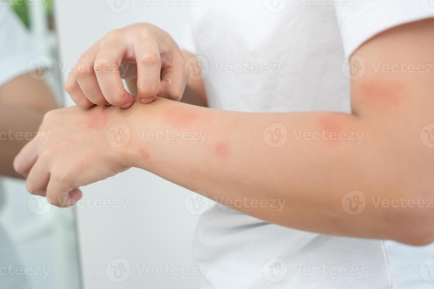 Skin and beauty problems Women have itchy skin and red rashes from cosmetic allergies, steroid allergies, sensitive skin, redness from sunlight, chemical allergies, rashes. photo