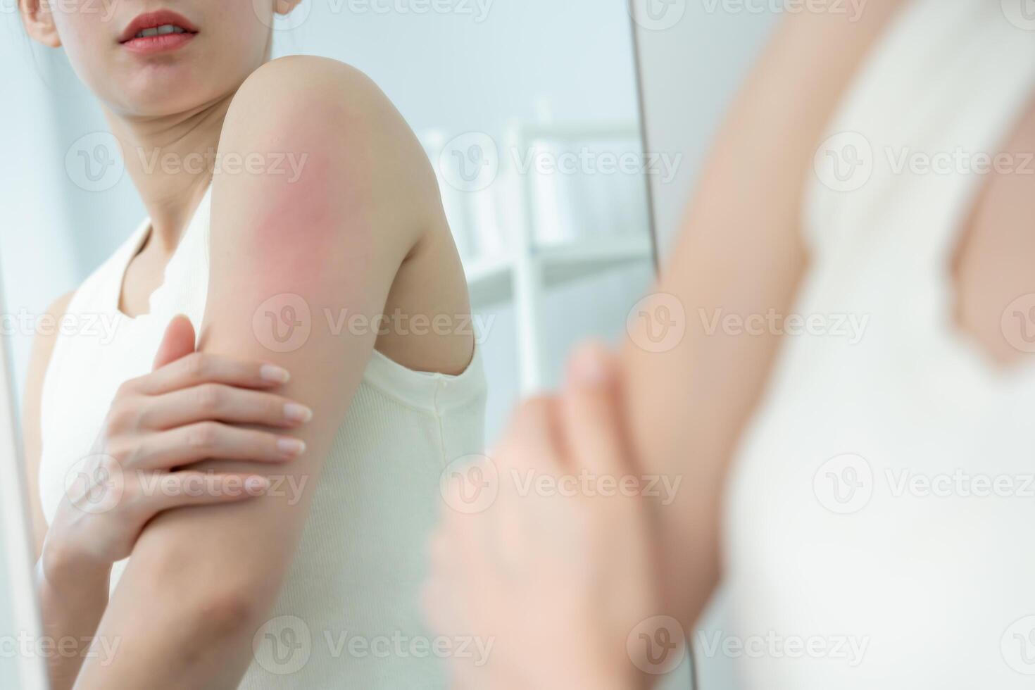 skin problem and beauty. scratch body has itchy skin from skin allergic, steroid allergy, sensitive skin, red from sunburn, chemical allergy, rash photo