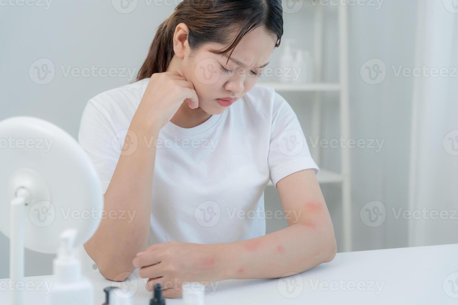 skin problem and beauty. Young woman scratch body has itchy skin from skin allergic, steroid allergy, sensitive skin. red from sunburn, chemical allergy, rash, insect bites, Seborrheic Dermatitis. photo