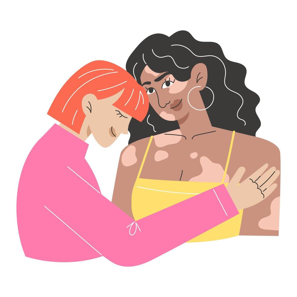 Modern Flat Style Illustration of Interracial Lesbian Couple with Vitiligo Representing LGBTQ Diversity and Equality vector