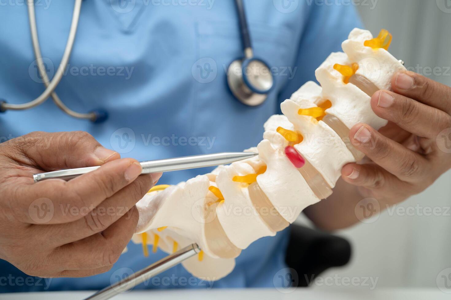 spinal nerve and bone model, Lumbar spine displaced herniated disc photo