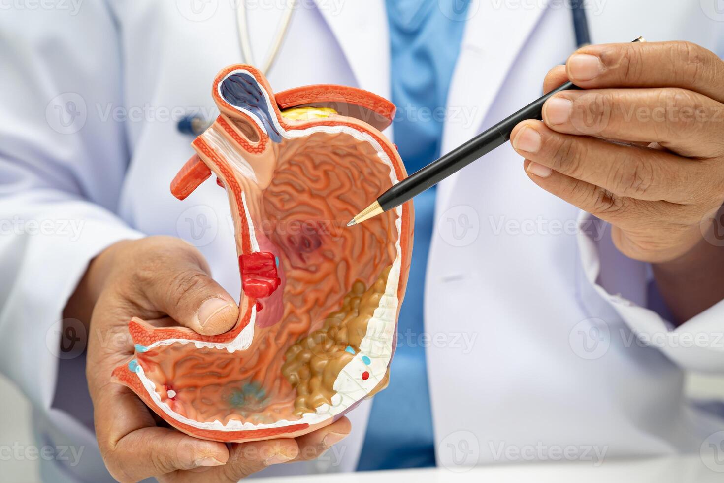 Stomach disease doctor photo