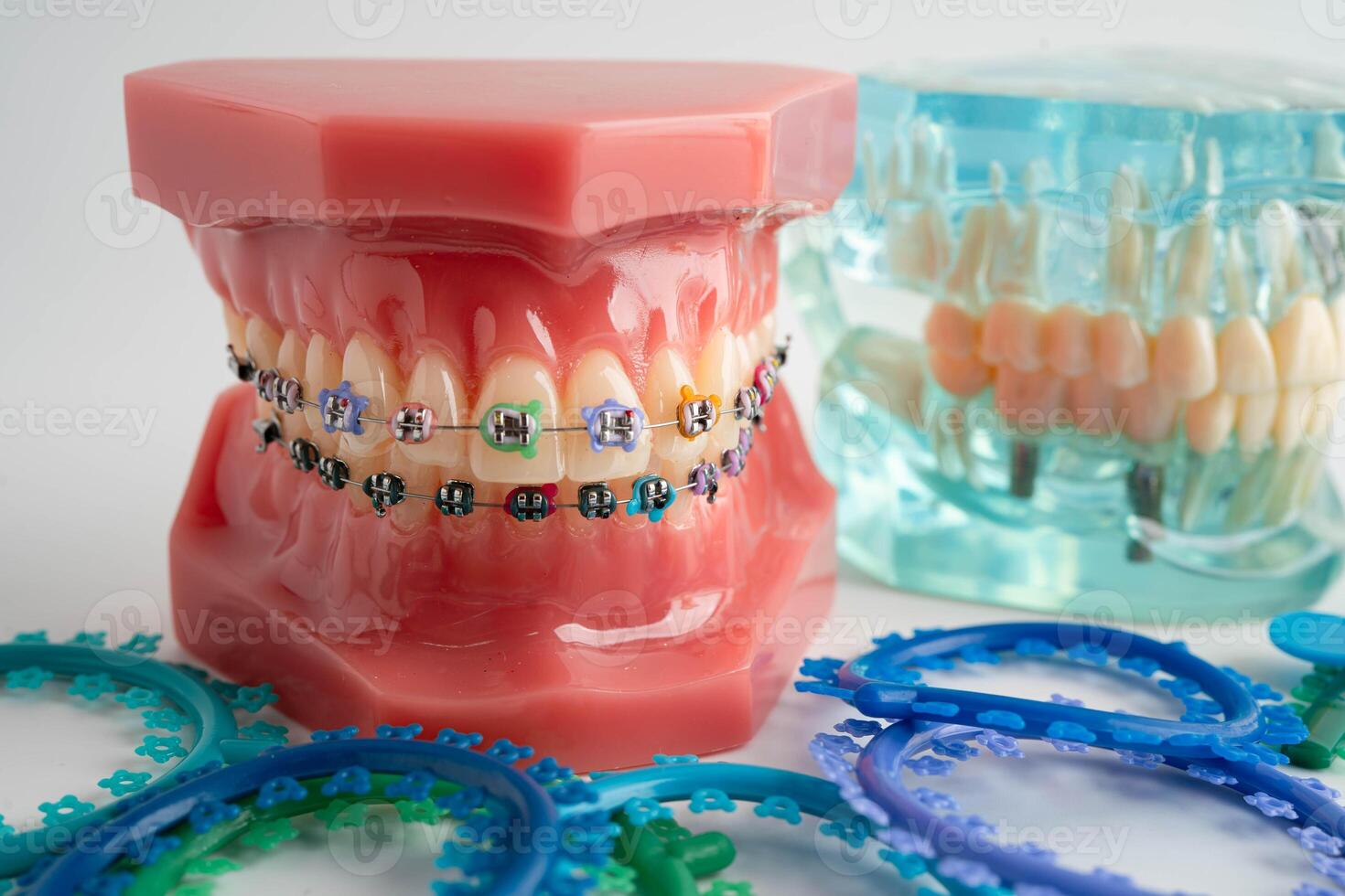 Orthodontic ligatures rings and ties, elastic rubber bands on orthodontic braces, model dentist photo