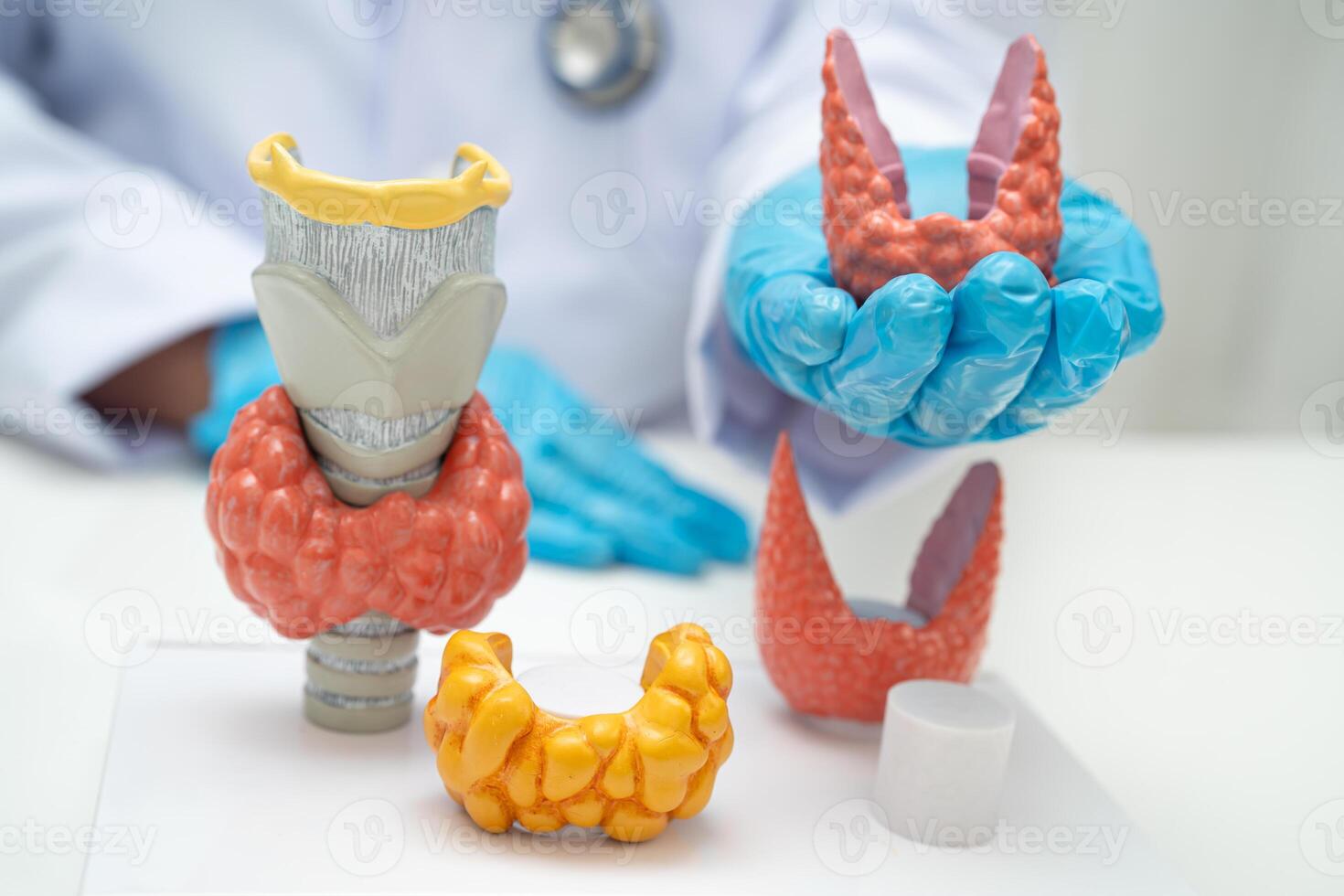 Hyperthyroidism Overactive Thyroid, Thyroid Lymphoma, Asian doctor with thyroid photo