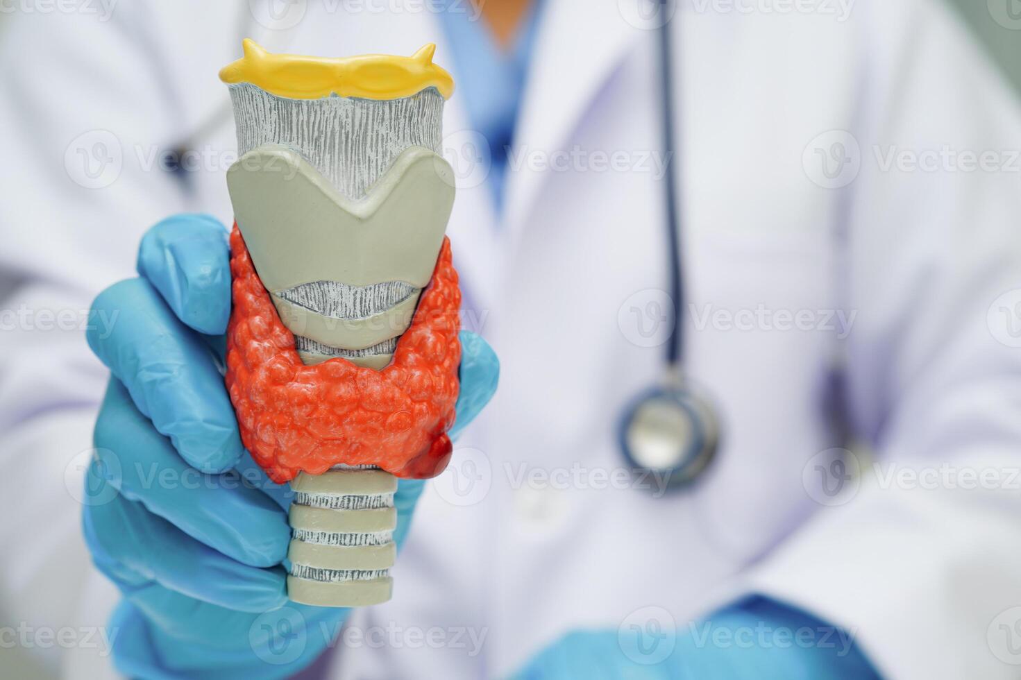 Hyperthyroidism Overactive Thyroid, Thyroid Lymphoma doctor thyroid gland photo