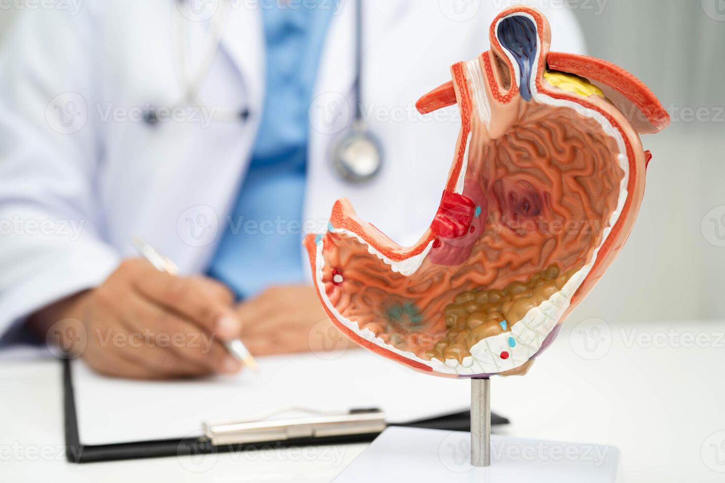 Stomach disease doctor holding anatomy model diagnosis photo