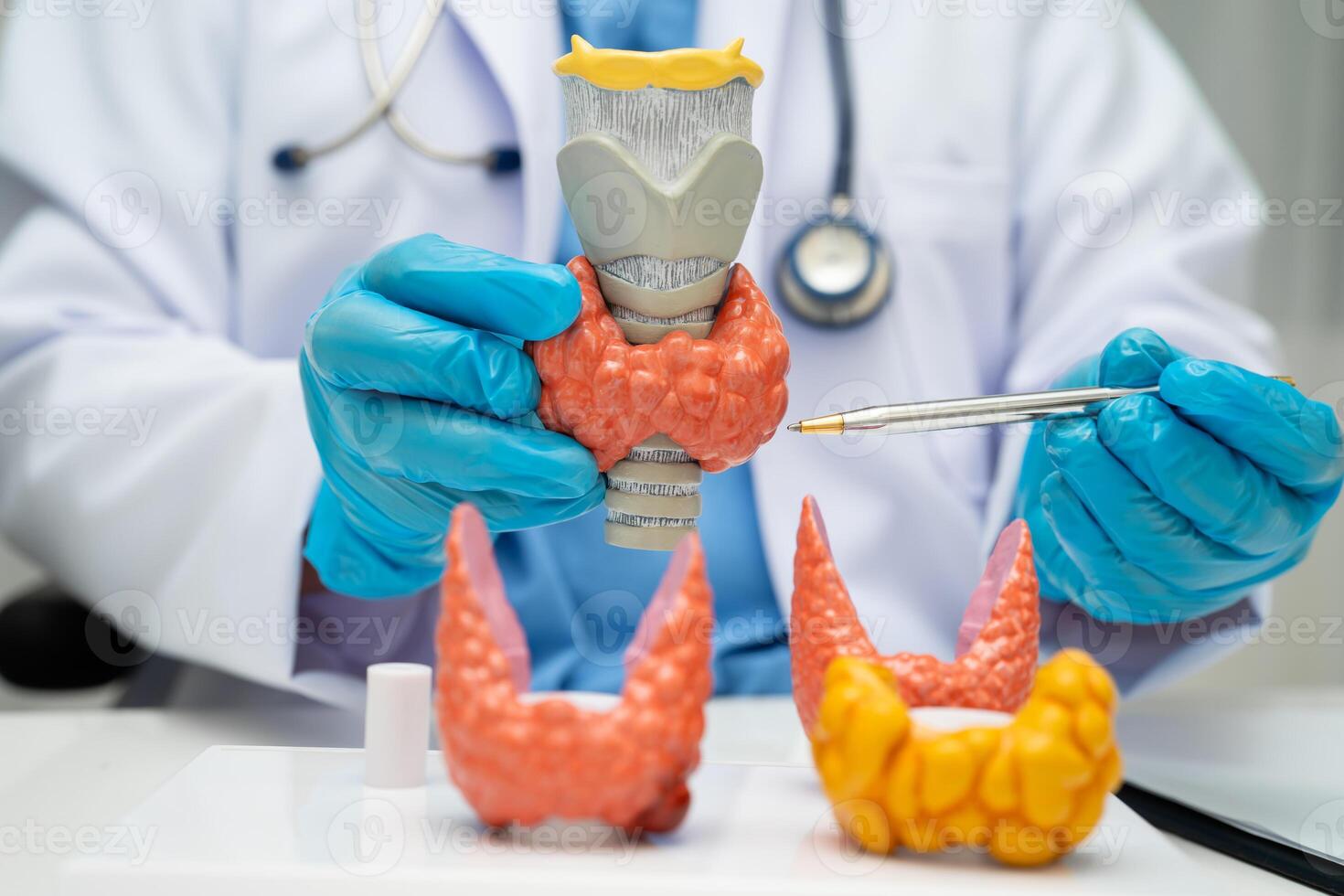 Hyperthyroidism Overactive Thyroid, Thyroid Lymphoma, Asian doctor thyroid gland photo