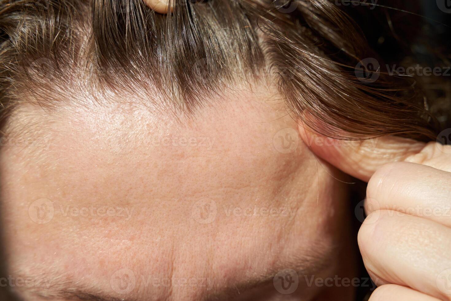 Close-up of young caucasian female showing scalp with light brown hair and healthy skin detail. photo