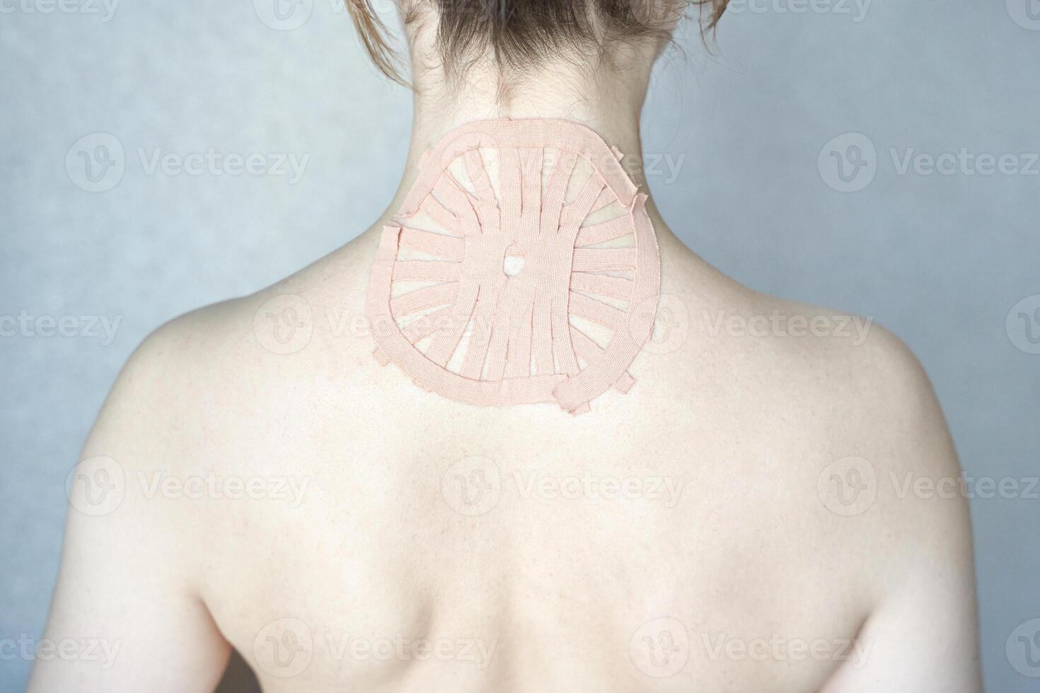 Female adult caucasian back with therapeutic tape applied for pain relief and muscle support. photo