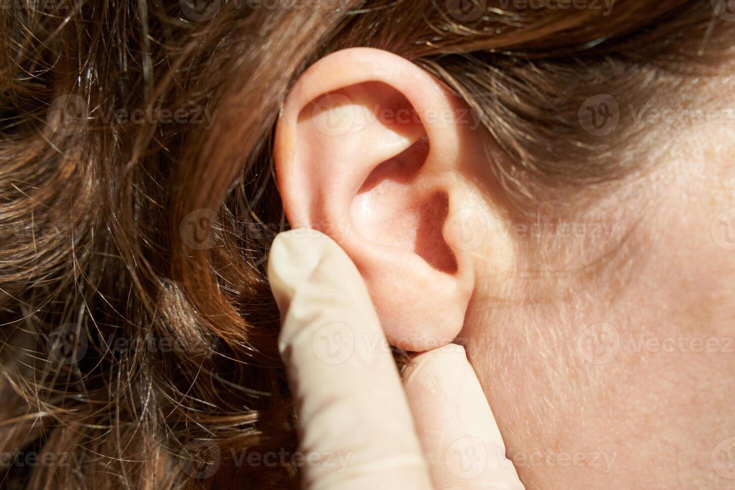 Female caucasian adult ear examined by gloved hand in close-up image highlighting ear health. photo