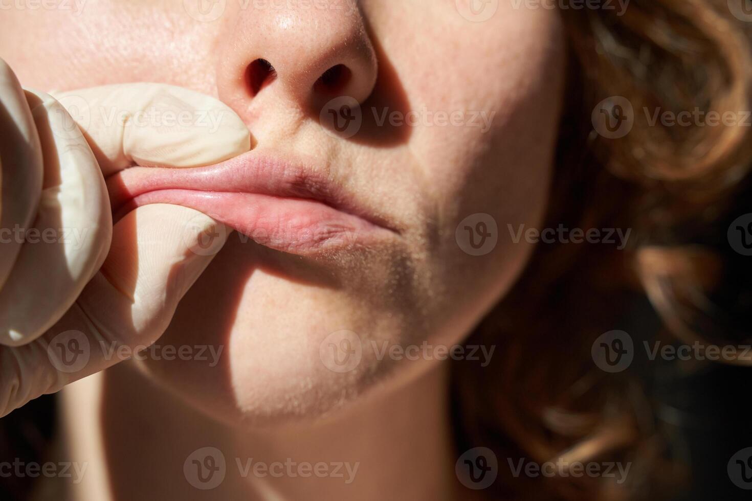 Close-up of female receiving dental examination by gloved hands in medical setting. photo