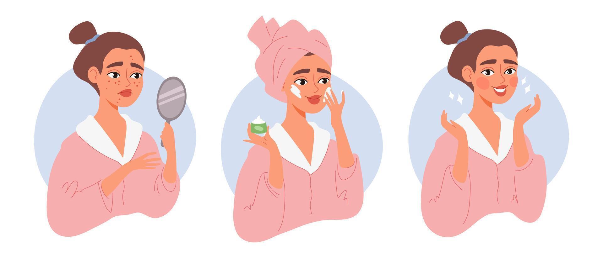 Young woman treating acne with face cream. Three-step skincare routine. skin problem, cream application, and clear glowing skin. Beauty treatment and self-care concept vector
