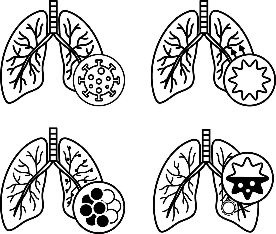 Icons of Lung Disease, Bronchitis, COPD, and Pneumonia. Icons of Various Lung Diseases. Healthcare and Medicine vector