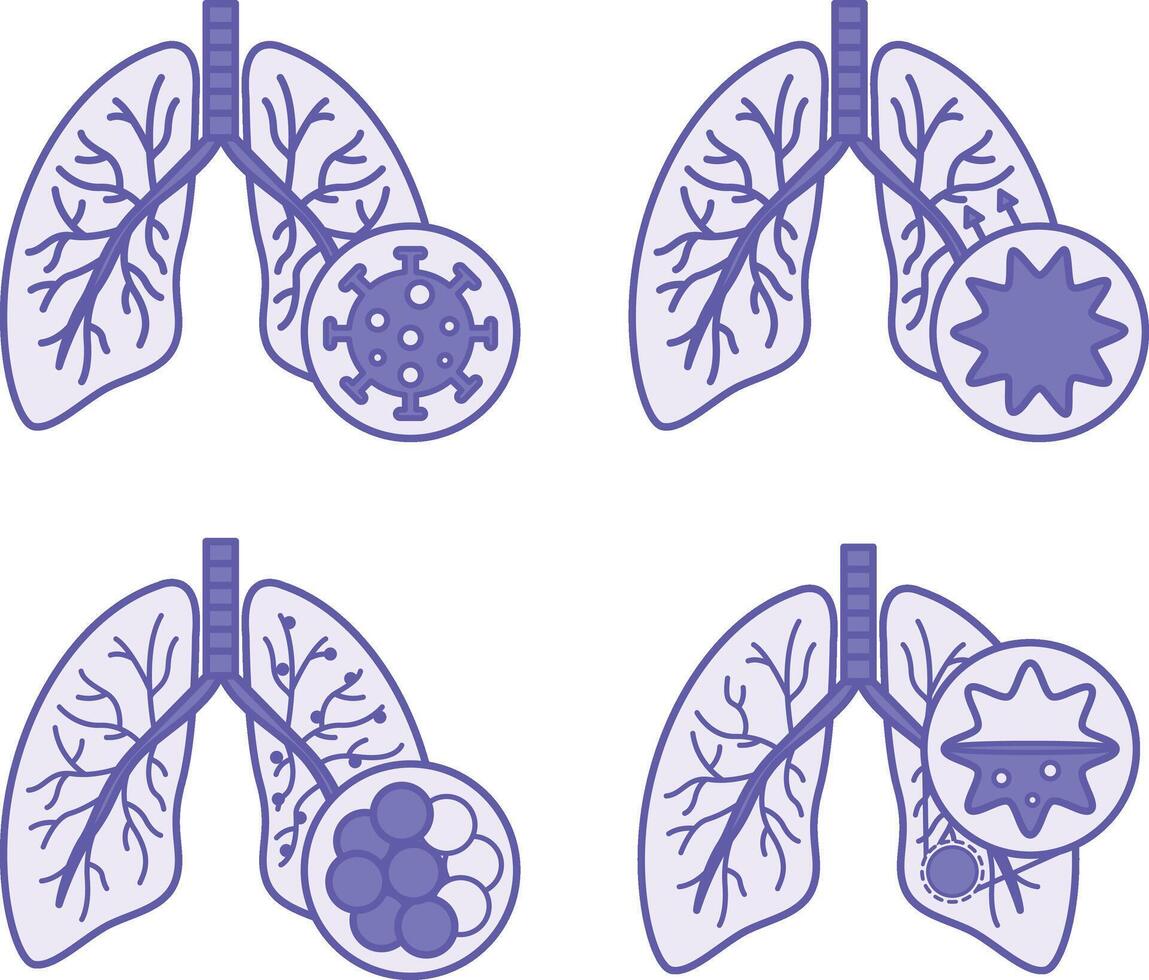 Colored Icons of Lung Disease, Bronchitis, COPD, and Pneumonia. Icons of Various Lung Diseases. Healthcare and Medicine vector