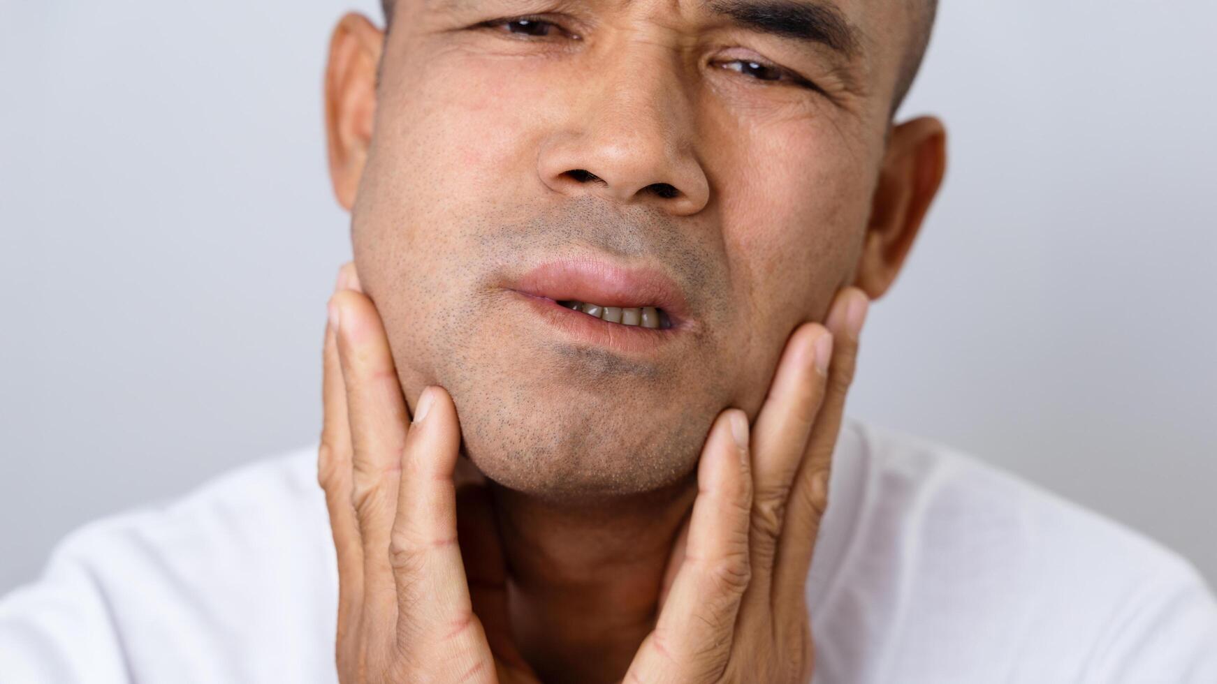 The Man has facial swelling due to an allergic reaction to triggers such as insect bites, food photo