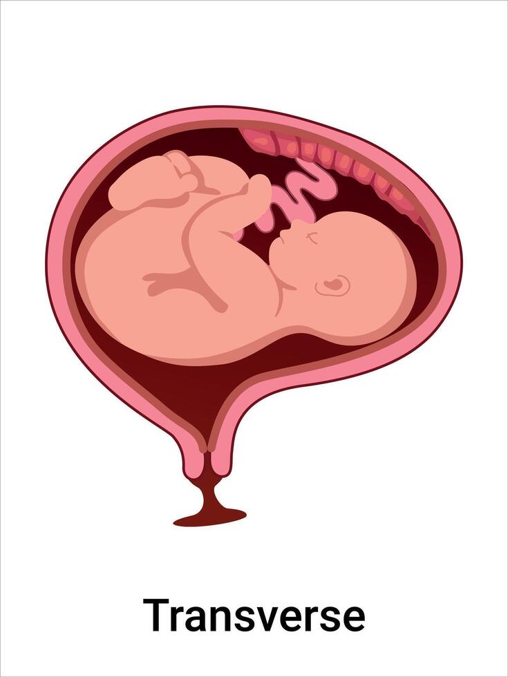 Transverse position of baby in womb vector