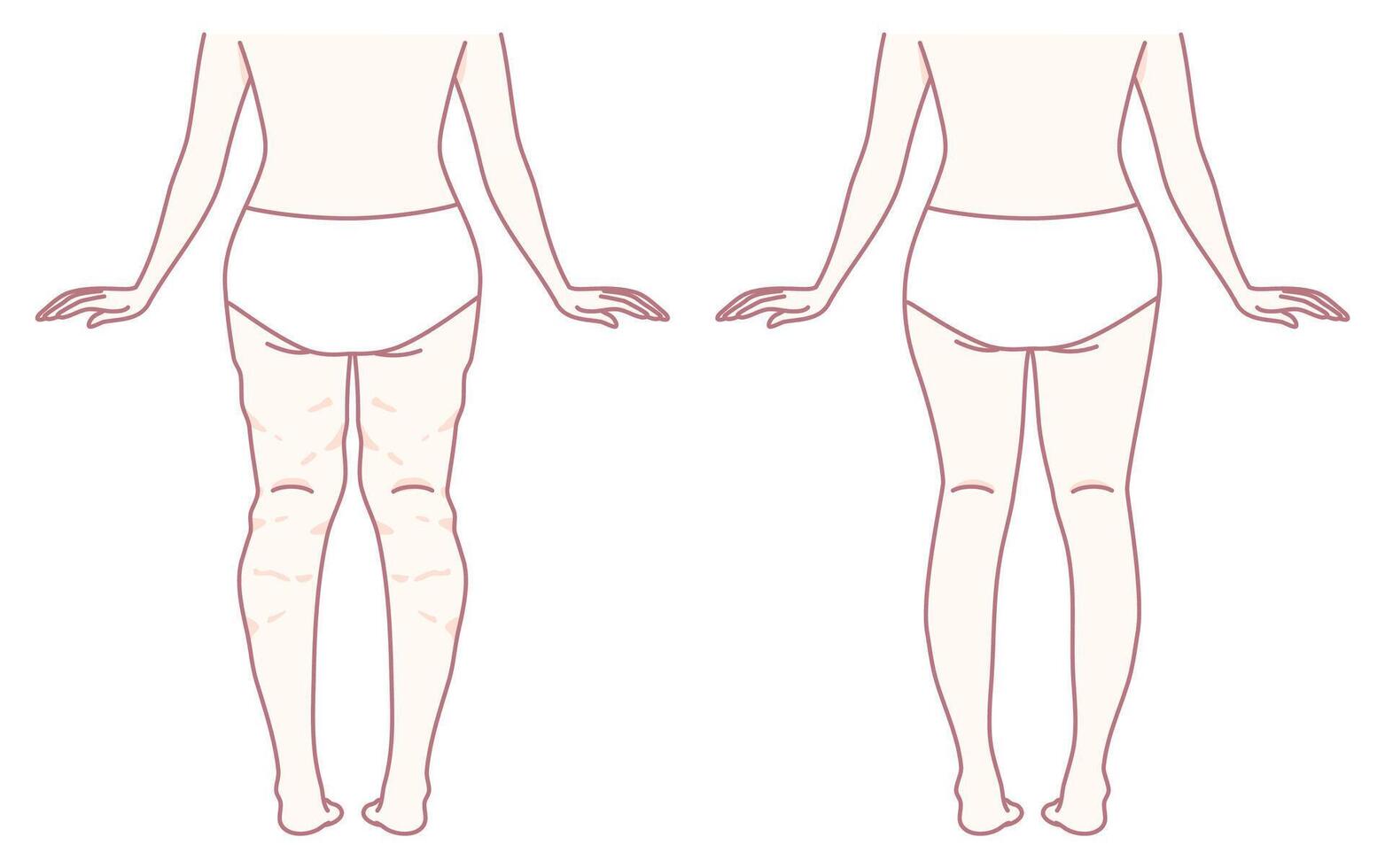 A Detailed Comparison of Leg Shapes Analyzing Before and After Transformational Changes vector
