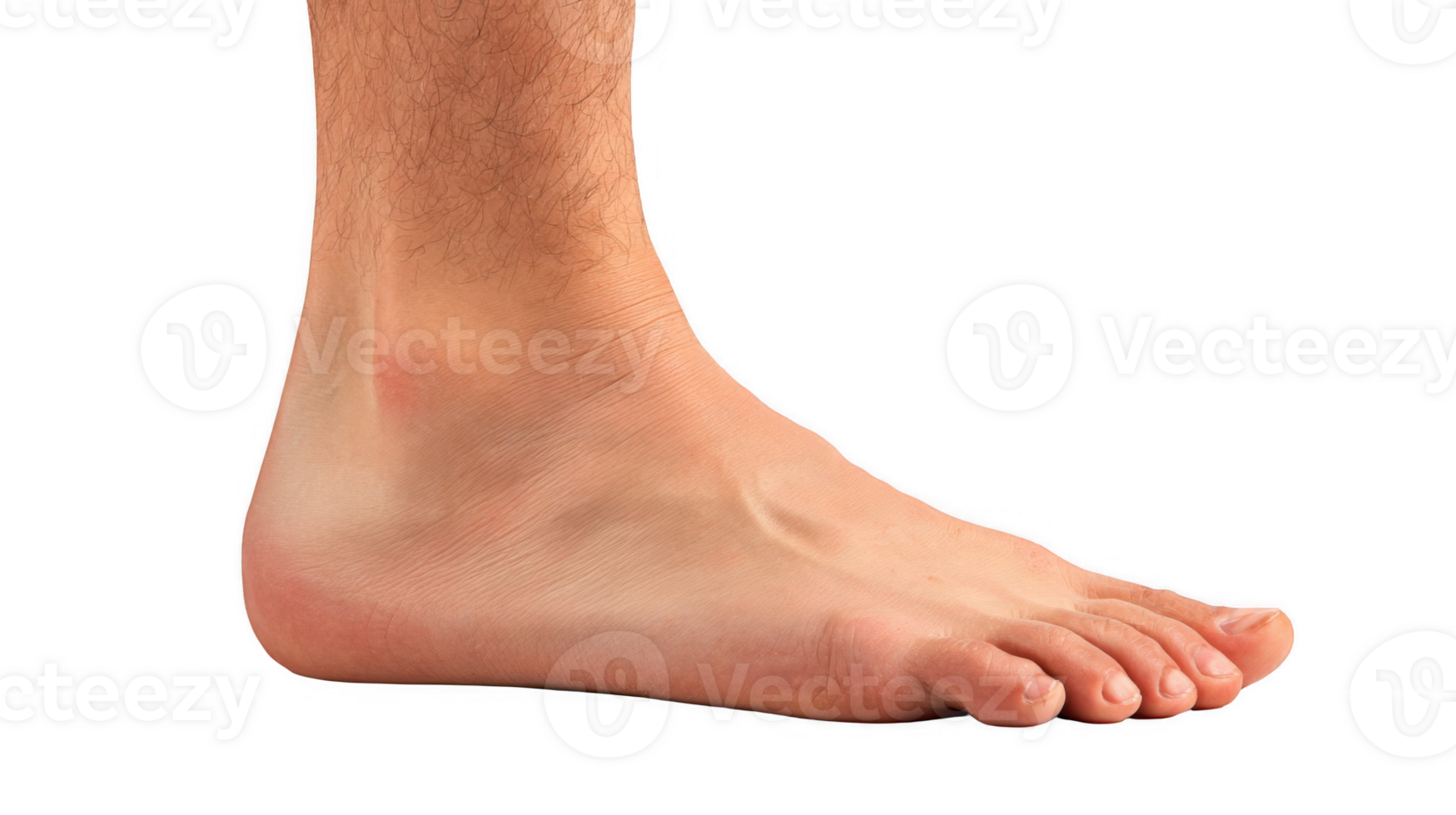 Swollen foot showing signs of inflammation on transparent background png