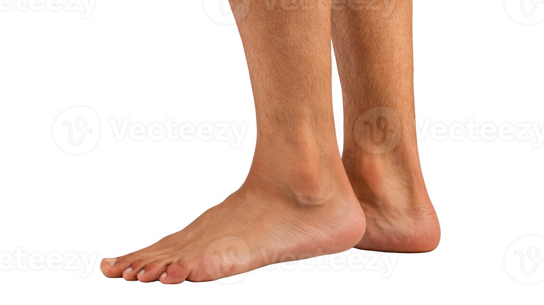Swollen ankle showing signs of inflammation on transparent background png